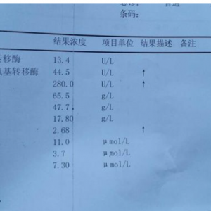 肝功能检查报告单